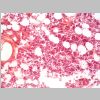 Medula osea HE 10.jpg